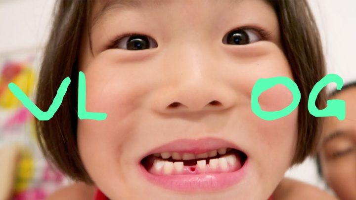 VLOG신우 첫니 빠진 날, 성공적! 신우티비