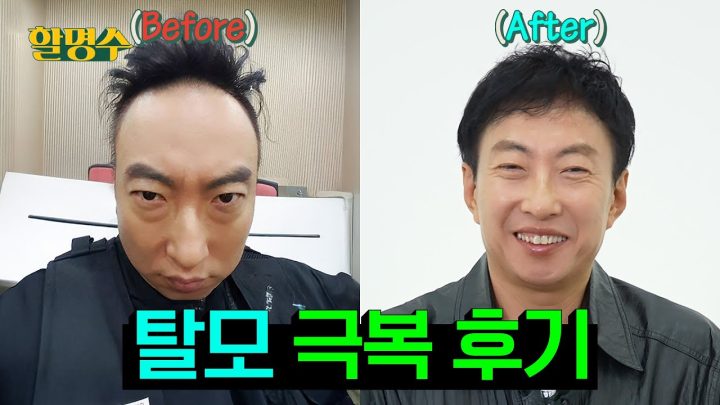 (ENG) 탈모는 늦었다고 생각할 때가 진짜 너무 늦었다 탈모 간증인의 Q&A👨‍🦲🤷‍♂️ | 할명수 ep.249