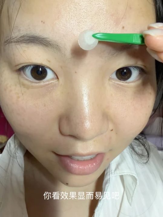 화메이 추천 여드름 패치