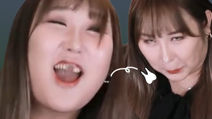 갑자기 이빨 빠진 썰 🦷